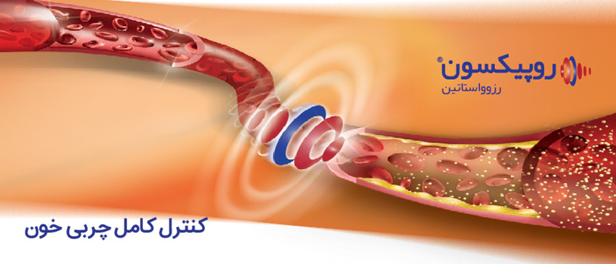 Ropixon | روپیکسون
