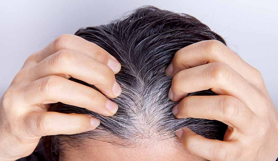 Dr.Abidi.علت موی سفید/The-cause-of-white-hair