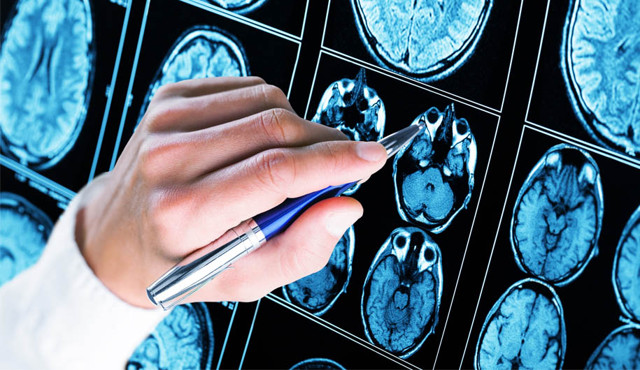 continue treatment epilepsy|ادامه درمان صرع در شرایط شیوع کرونا